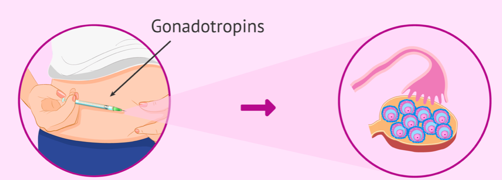 როგორ ხორციელდება სტიმულაცია in-vitro-ს დროს?